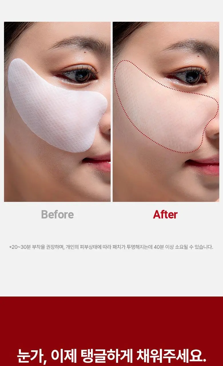 [아이백 개선/탄력볼륨] 메디테라피 링클핏 탱글 아이패치 4회분 상세페이지 18